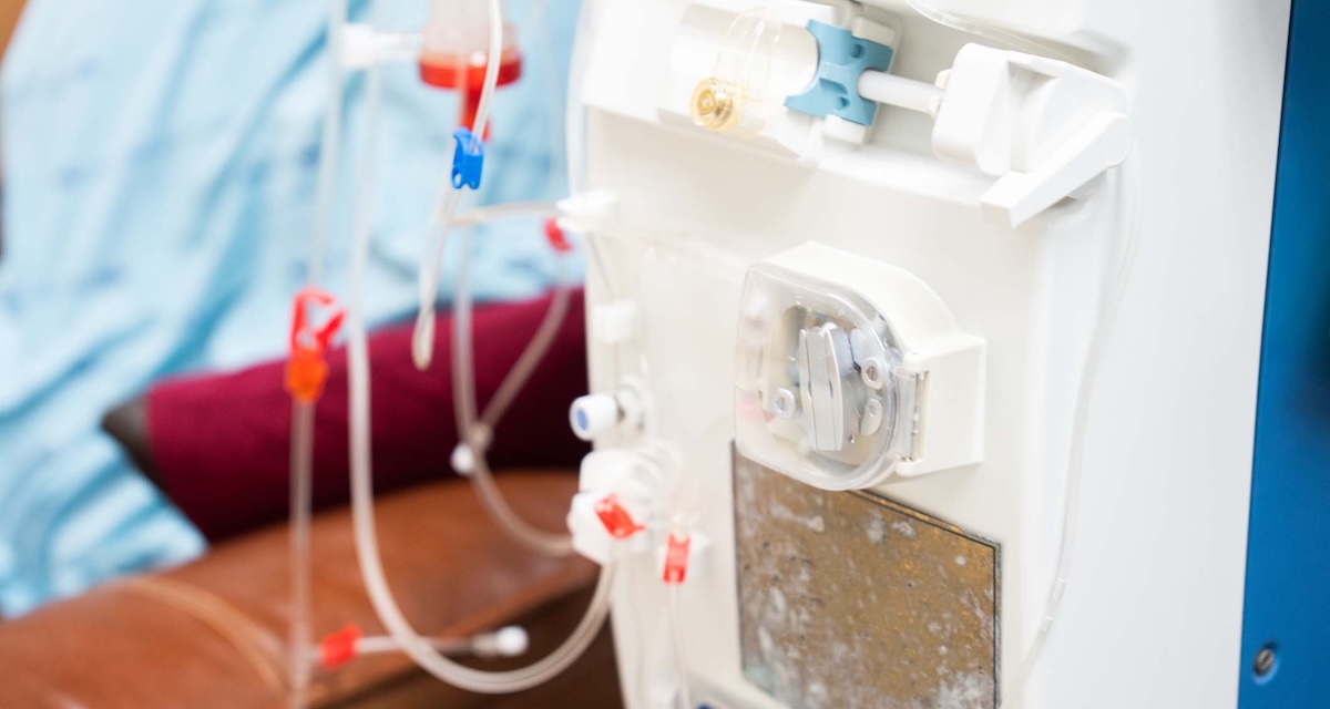 Dialysis machine