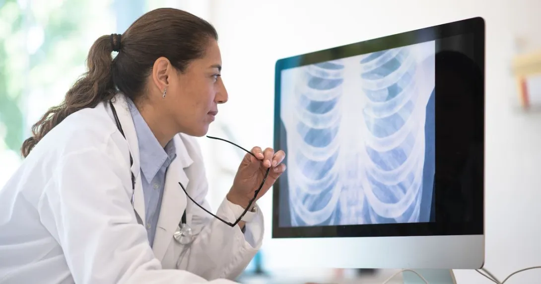 
  Doctor looking at a chest x-ray
