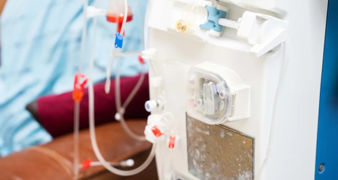 Dialysis machine